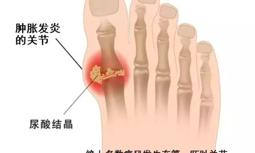 艾滋病病人容易感冒吗-hiv病人经常感冒吗网 - 网站提供艾滋病病人容易感冒吗小常识、hiv病人经常感冒吗会传染吗